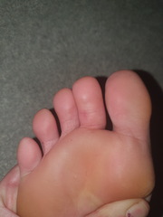 What's wrong with my toes.. pics included