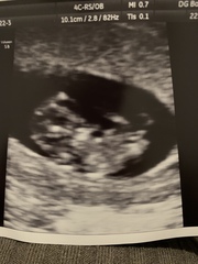 Gender predictions?