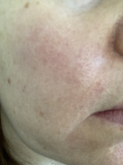 Totally baffled by skincare. Can anyone give me a cheap, simplified Hirons-esq routine?