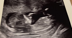 Do you want me to guess the sex? 12 week scans.