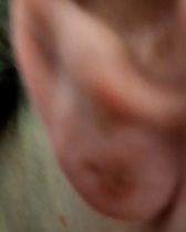 Infected piercing *warning photos*