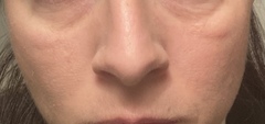 Can I fix my puffy, tired looking face (with photos)?