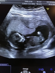12 week scan guess