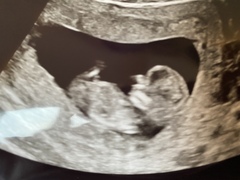 12 week gender guess?!?!