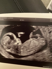Do you want me to guess the sex? 12 week scans.