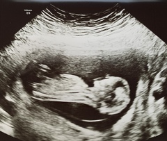 Do you want me to guess the sex? 12 week scans.