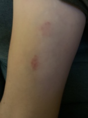 What is this on my DP's back? Done by another woman?