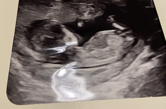 Do you want me to guess the sex? 12 week scans.