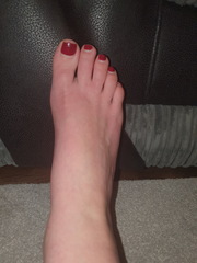 What's wrong with my toes.. pics included
