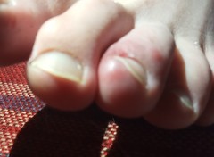 What's wrong with DS's feet?