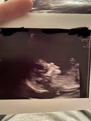 Scan pics - boy or girl?
