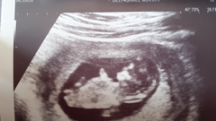 Do you want me to guess the sex? 12 week scans.
