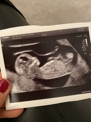 Do you want me to guess the sex? 12 week scans.