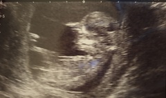 Gender Guesses 💖💙