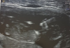 Gender Guesses 💖💙