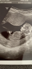 Do you want me to guess the sex? 12 week scans.