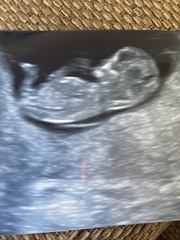 Do you want me to guess the sex? 12 week scans.