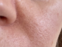 Totally baffled by skincare. Can anyone give me a cheap, simplified Hirons-esq routine?