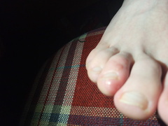 What's wrong with DS's feet?