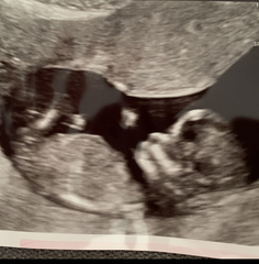 Do you want me to guess the sex? 12 week scans.