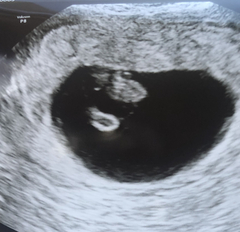 5 week scan