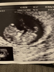 Gender predictions?