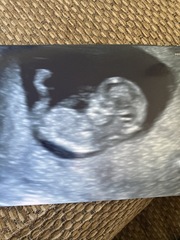 Do you want me to guess the sex? 12 week scans.