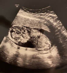 Do you want me to guess the sex? 12 week scans.