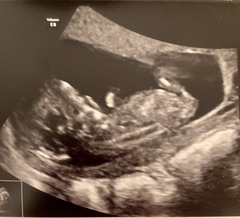 Do you want me to guess the sex? 12 week scans.
