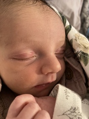 9 day old with red, puffy eyelids. Picture attached