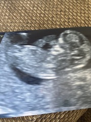 Boy or girl guess please!