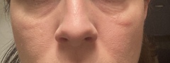 Can I fix my puffy, tired looking face (with photos)?