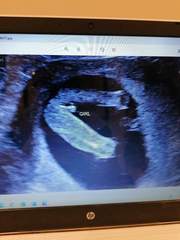 Sonographers/mum of girls - is this really a girl?