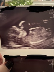 Scan pics - boy or girl?