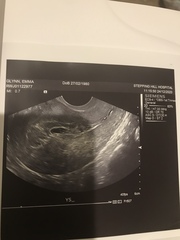 Support thread for women who are pregnant or TTC following a termination for abnormalities. Thread 7