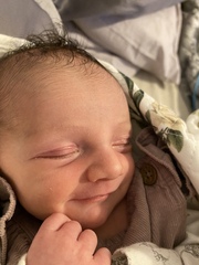 9 day old with red, puffy eyelids. Picture attached
