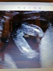 Sonographers/mum of girls - is this really a girl?
