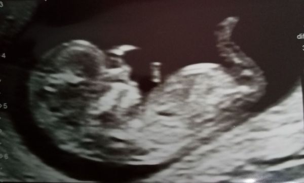 Do you want me to guess the sex? 12 week scans.