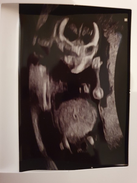 Do you want me to guess the sex? 12 week scans.