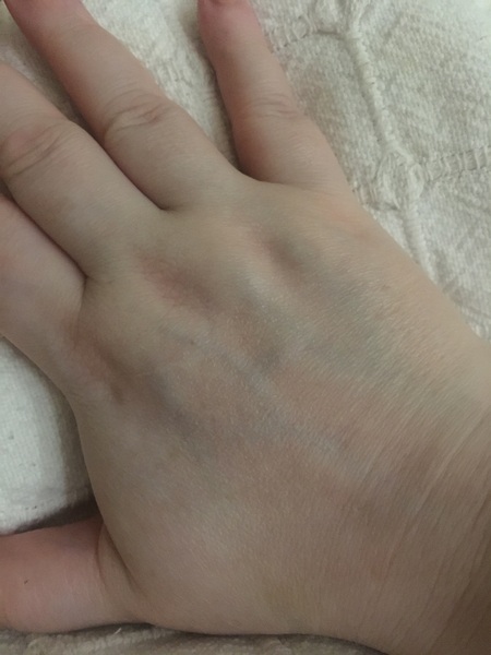 My hands look like a wrinkly scrotum. Help.