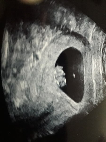 August 2021 - Scans and booking in!