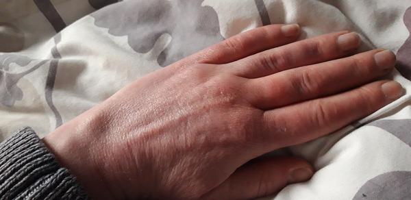 Does anyone want to play 'guess the age of my hands?
