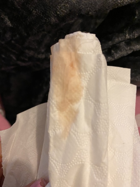 Bleeding one day after heatbeat on scan GRAPHIC