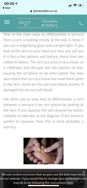 Is this a verruca or a corn/callus?
