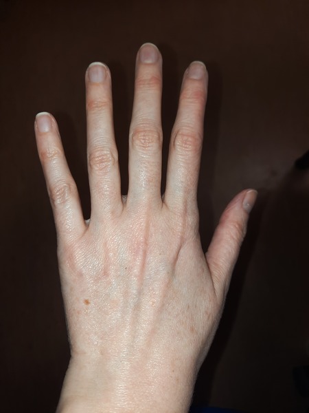 Does anyone want to play 'guess the age of my hands?