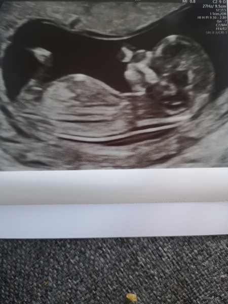 TTC after MC - Dec/Jan 2020 (Thread 16)