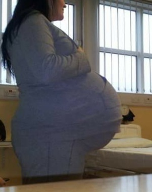 Any big mummy’s prescribed higher amount folic