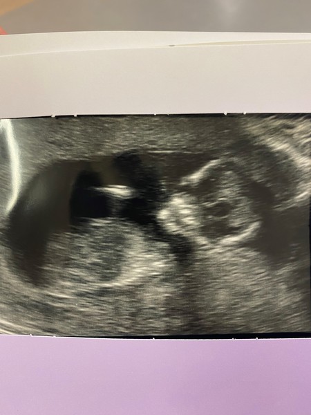 Any guesses :)