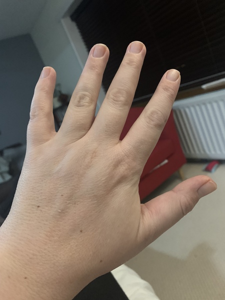 Does anyone want to play 'guess the age of my hands?