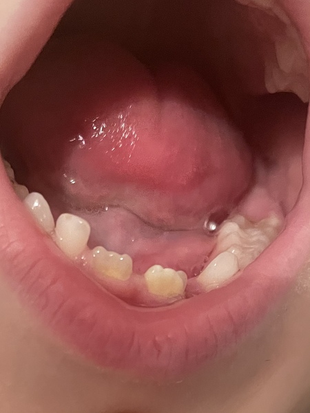 Is there a dentist about who can take a look at this photo?